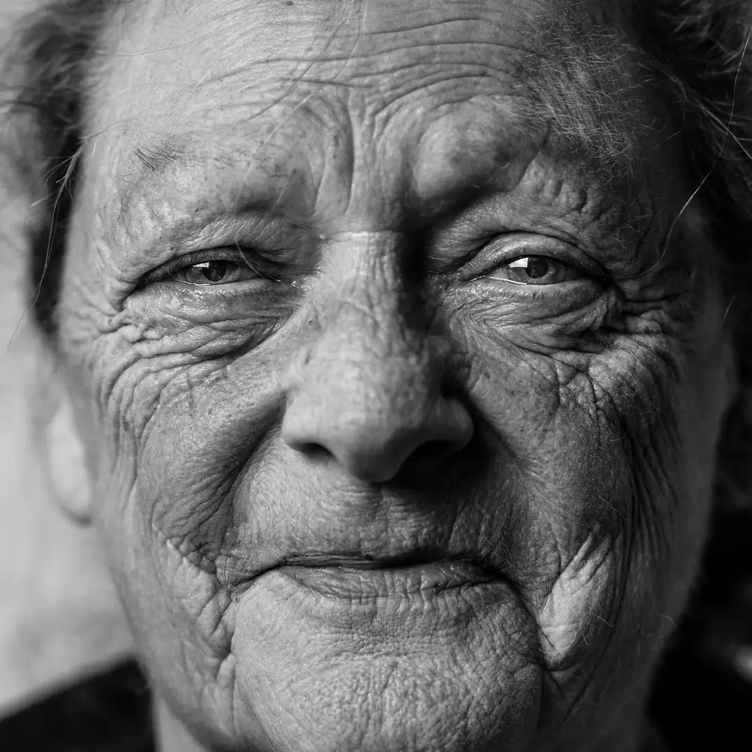 What is Weathered Skin in Older Adults?